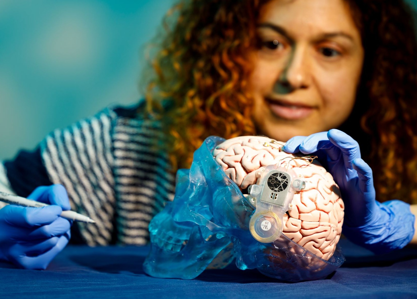 ABILITY implant on brain model